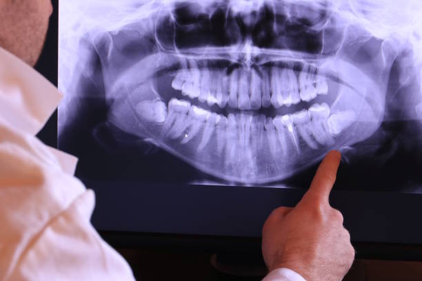 Best Emergency Treatment for Dental Infections or Abscesses in North Madison, OH