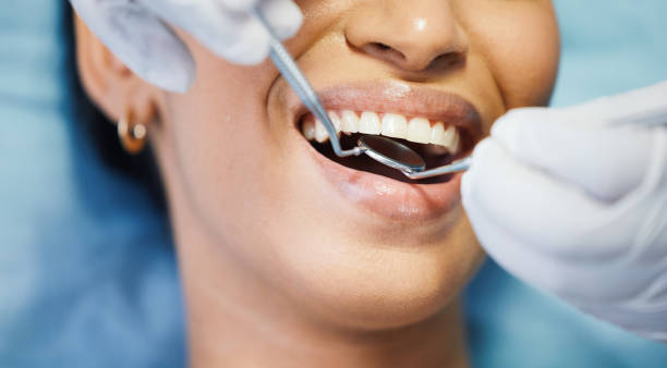 Best Emergency Dental Care for Broken or Chipped Teeth in North Madison, OH